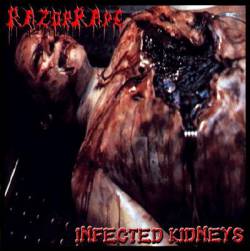 RazorRape : RazorRape - Infected Kidneys